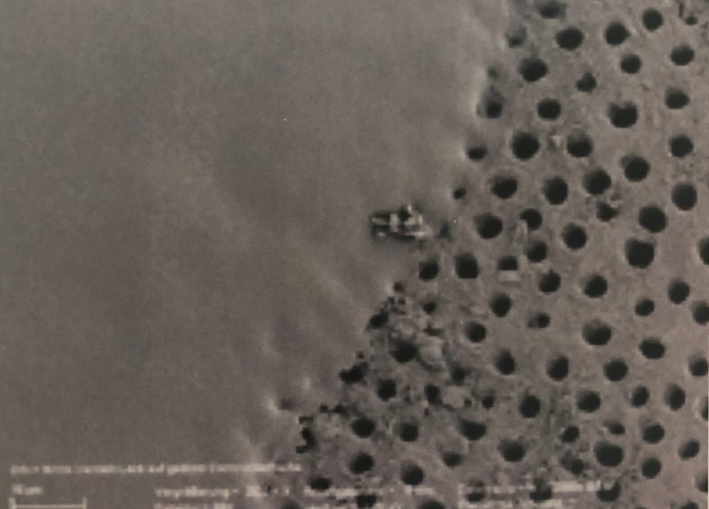 Fluoride treatment after dental cleaning Eau Claire Park Dental