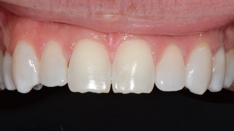 Cosmetic Dentistry