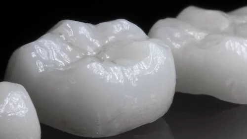 what is dental crown | Dentist Downtown Calgary | Eau Claire Park Dental