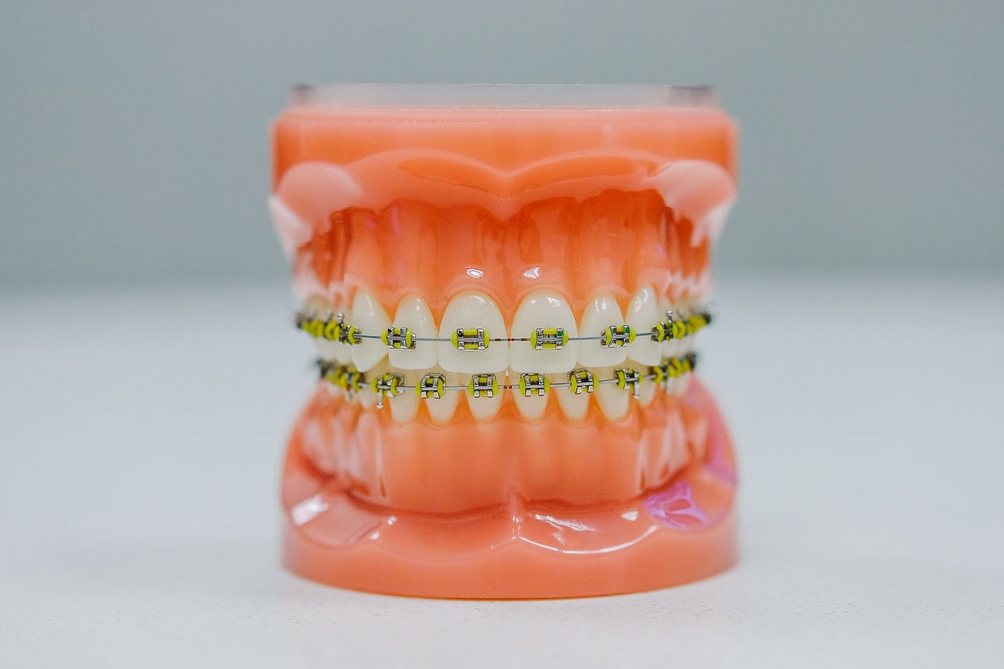 Ceramic Braces vs Invisalign - Schedule a Free Consultation Today