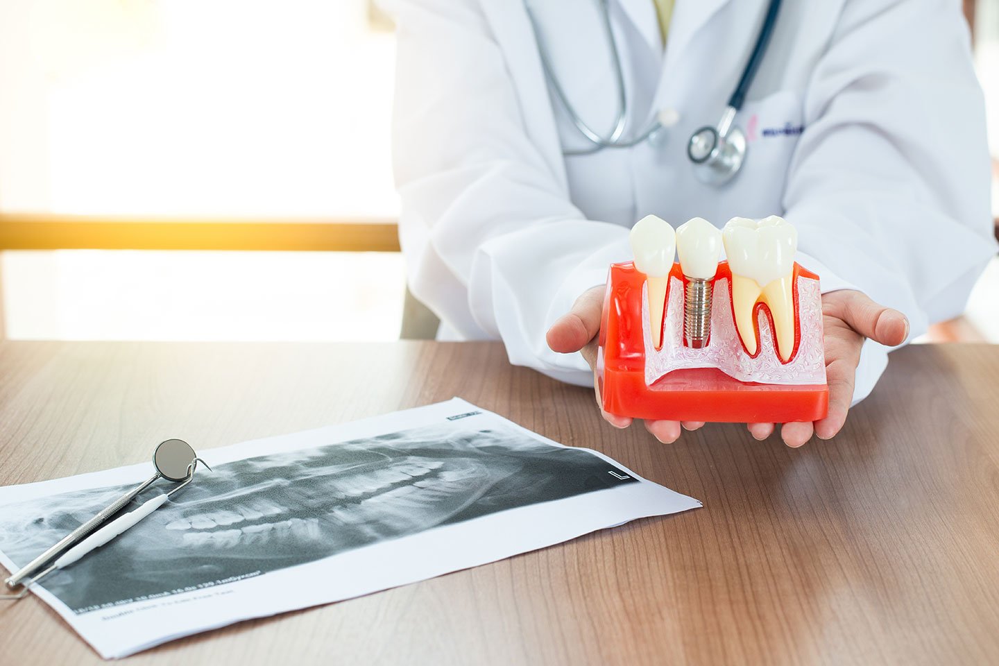 Can Dental Implants Cause Gum Disease?