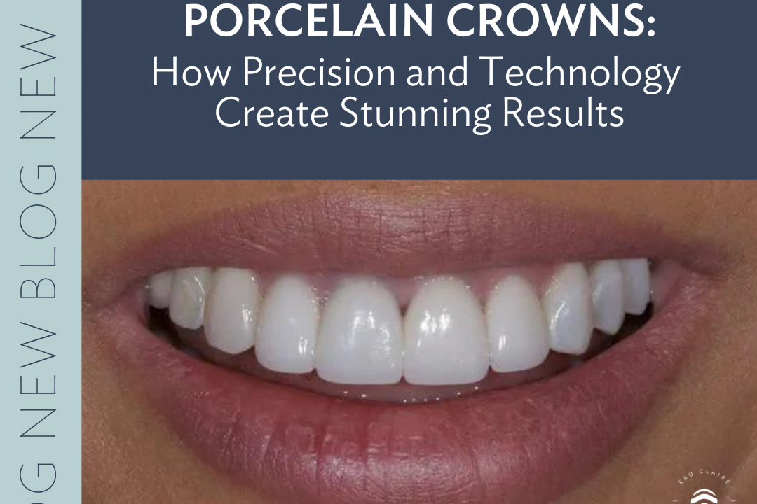 Porcelain Crowns