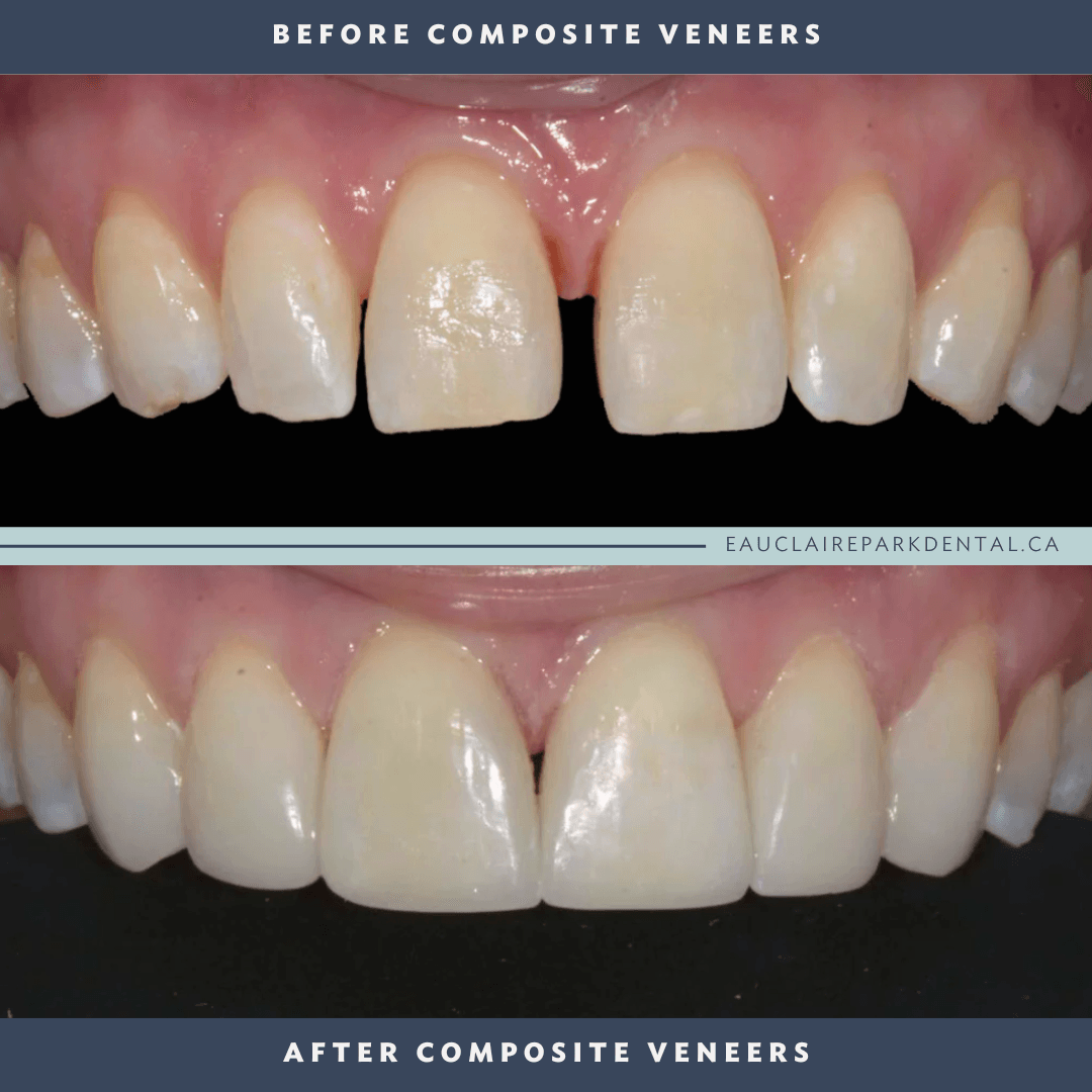 before-after-venners-2